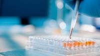 Lab technician injecting liquid into a microtiter plate